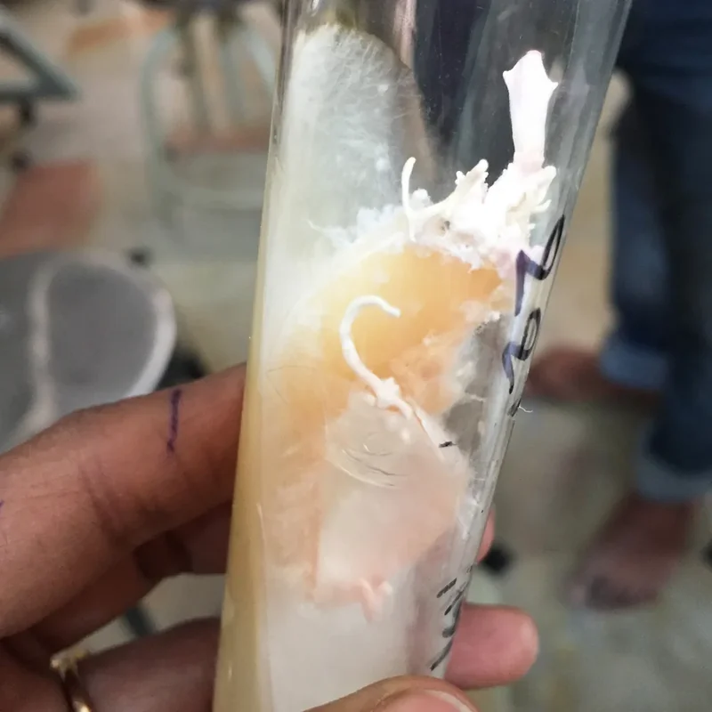 A hand holding a glass tube with a white fungal culture, from Botto's Insulium archive